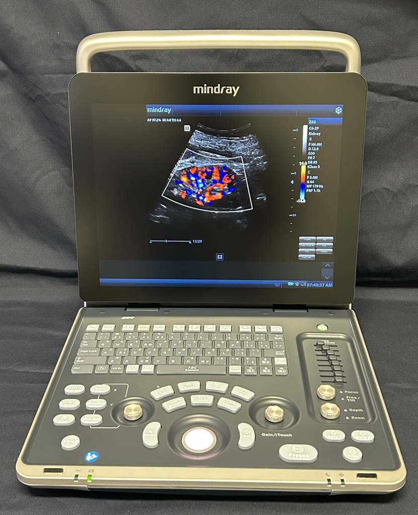 Z60 Ultrasound Colorflow Portable Ultrasound