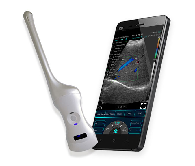C10QT Dual-Probes Multipurpose Ultrasound Convex + Endocavity +Cardiac Probe