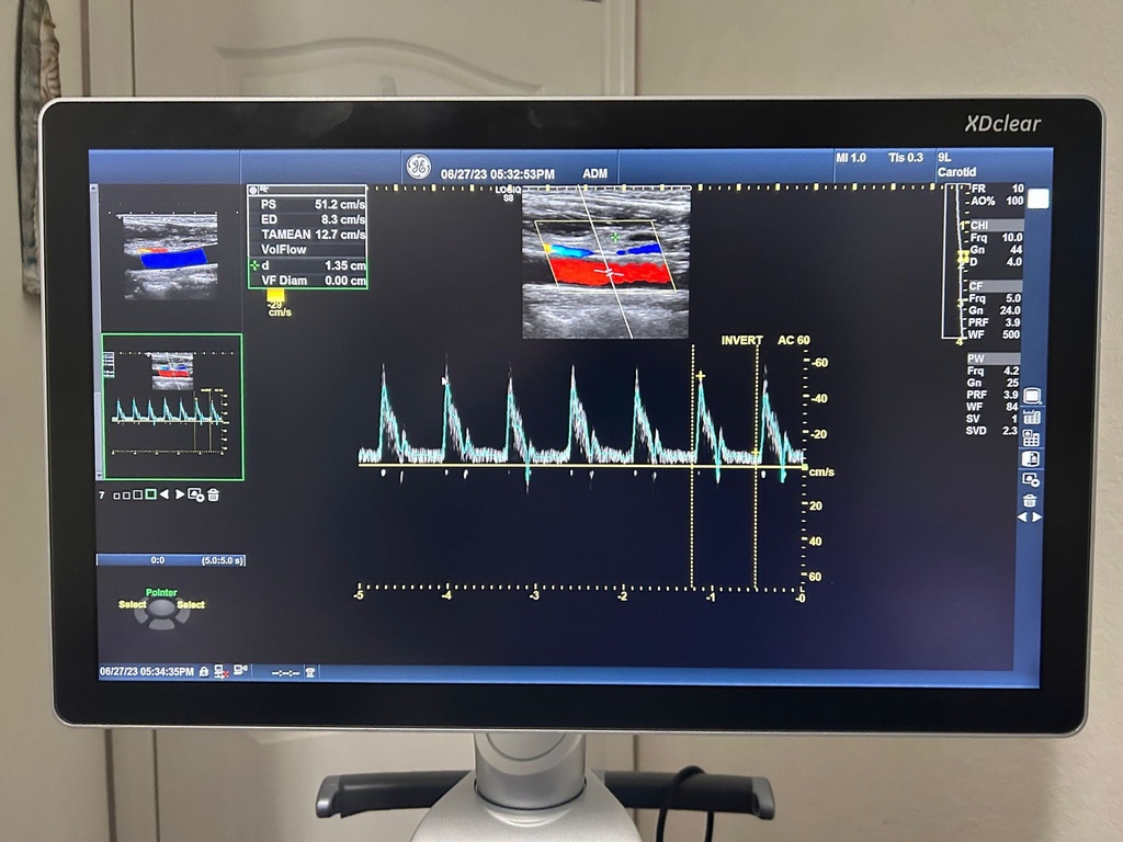 GE Logiq S8 Colorflow Ultrasound machine - Preowned