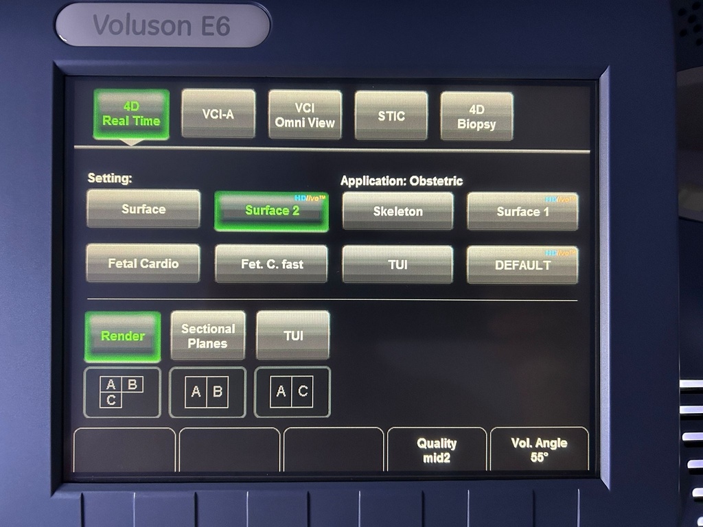 GE Voluson E6 Colorflow Doppler - Preowned