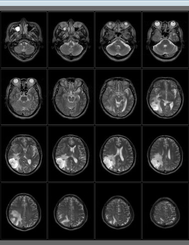 PICA MRI System Demo 1