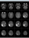 PICA MRI System Demo 1