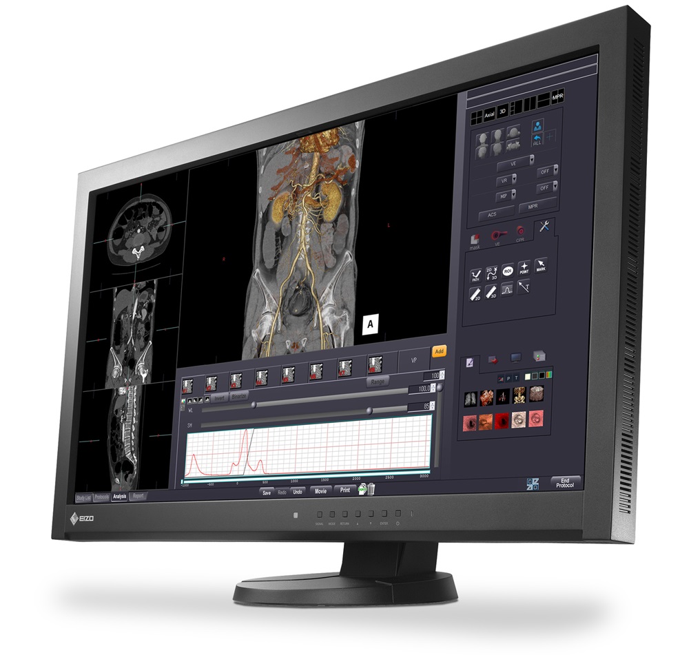 Eizo RadiForce MX270W 3.7MP 68cm (27") COLOR LCD MONITOR